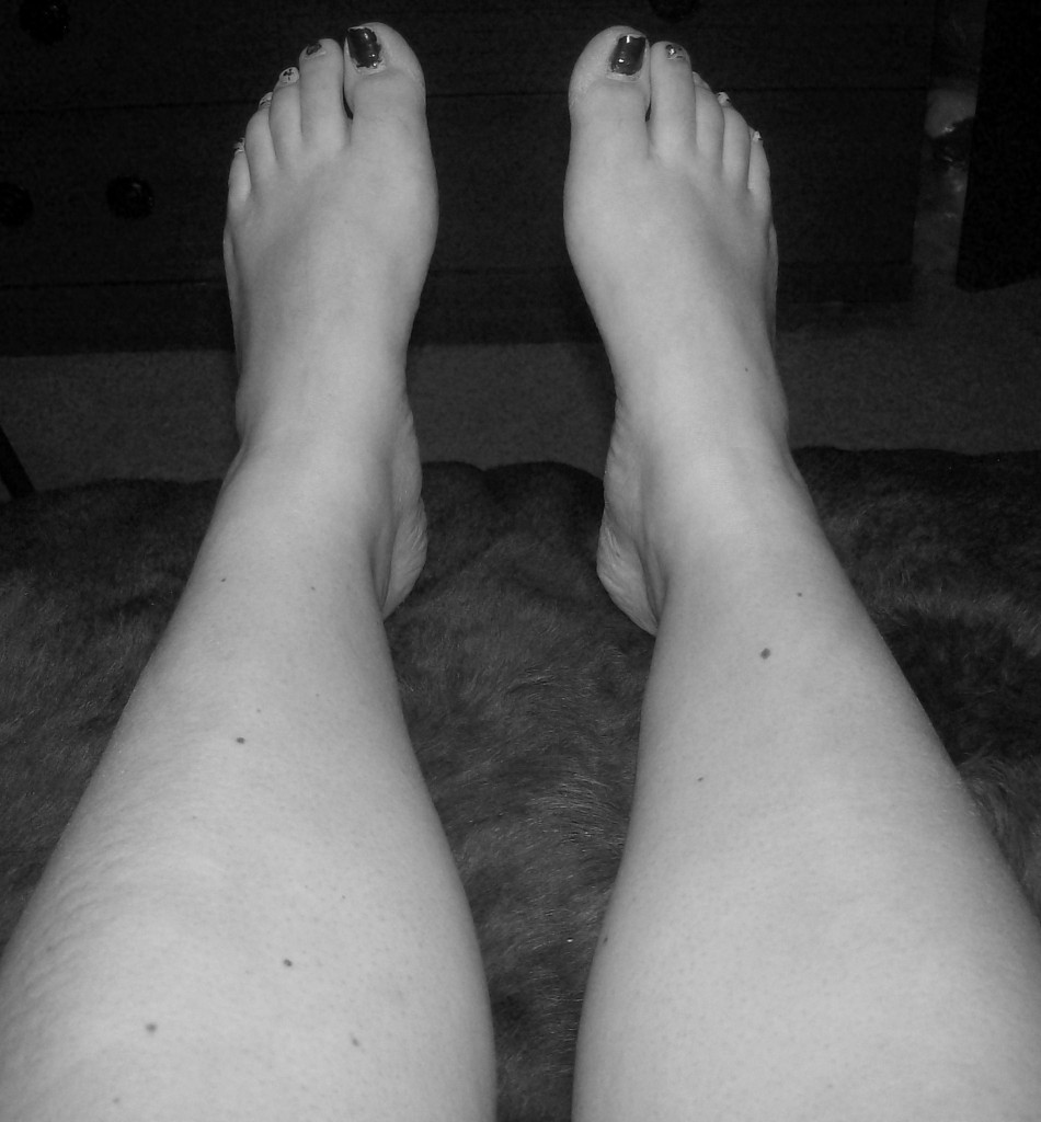 My restless legs
