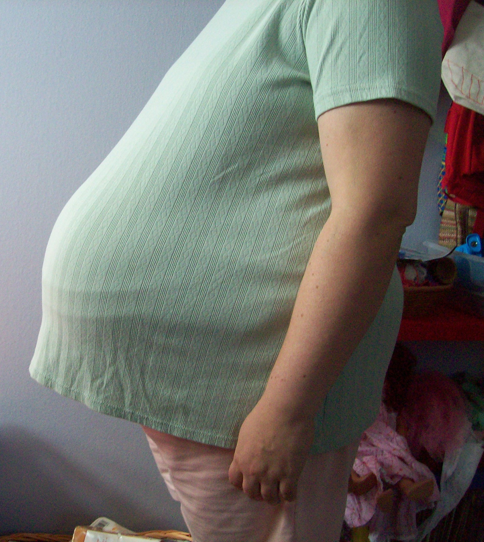 Pregnancy Support Garments for a Diastasis Recti