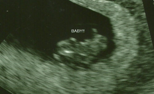 Baby #8