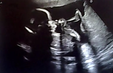 baby18wks